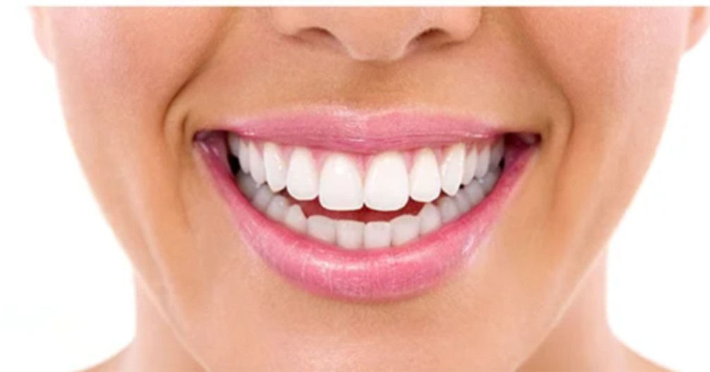 SP-6 – Dentifrice Blanchissant Premium aux Probiotiques