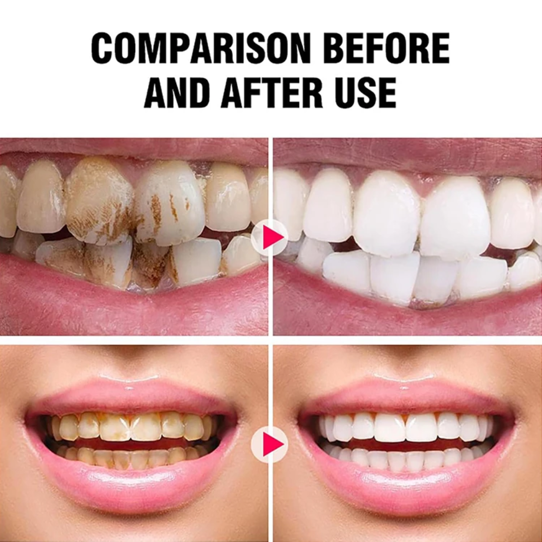 Bright White – Dentifrice Éclaircissant à la Niacinamide